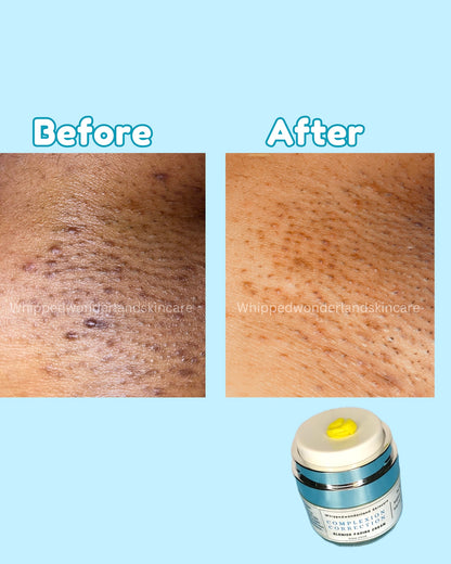 Complexion Correction - Blemish fading cream