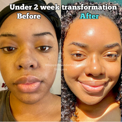 Hello Clear Skin - Turmeric Face soap bar; Hyperpigmentation, Acne, Scarring, Uneven Skin Clearing Soap